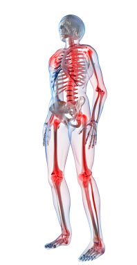 Romatoid Artrit: Nedir, sebepleri, belirtileri, teşhisi ve tedavisi